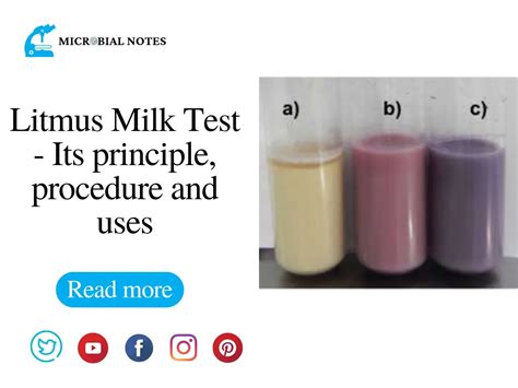 litmus milk test|Litmus Milk Test – Its principle, procedure, and uses.